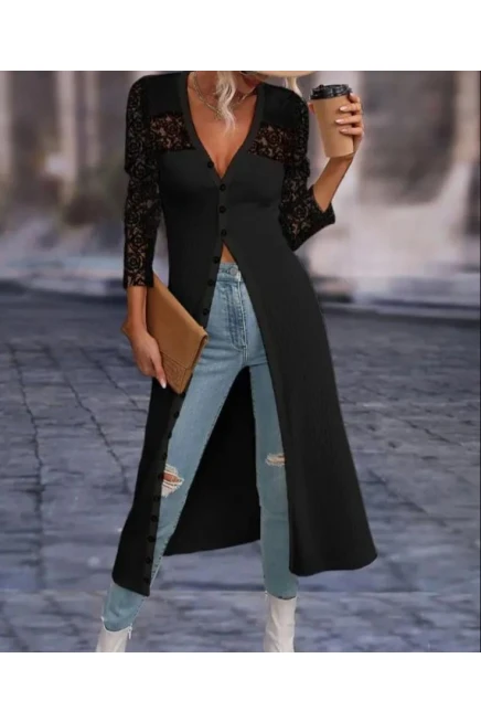 Dalgıç Kumaş Dantel Detaylı Komple Düğmeli Elbise